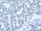 Heterogeneous Nuclear Ribonucleoprotein H3 antibody, ARP40721_T100, Aviva Systems Biology, Immunohistochemistry paraffin image 