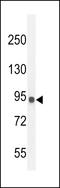 Interleukin 12 Receptor Subunit Beta 2 antibody, LS-B10479, Lifespan Biosciences, Western Blot image 