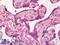 Platelet Derived Growth Factor Receptor Alpha antibody, LS-B8655, Lifespan Biosciences, Immunohistochemistry paraffin image 