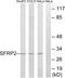 Secreted frizzled-related protein 2 antibody, LS-C120353, Lifespan Biosciences, Western Blot image 