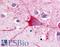 TRFR antibody, LS-A1196, Lifespan Biosciences, Immunohistochemistry paraffin image 