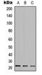 HDGF Like 3 antibody, abx121618, Abbexa, Western Blot image 