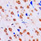 Checkpoint Kinase 1 antibody, LS-C352005, Lifespan Biosciences, Immunohistochemistry paraffin image 
