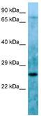 LBH Domain Containing 1 antibody, TA331749, Origene, Western Blot image 