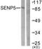 SUMO Specific Peptidase 5 antibody, TA311669, Origene, Western Blot image 