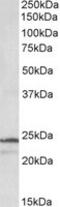 Proteasome Subunit Beta 3 antibody, MBS422452, MyBioSource, Western Blot image 