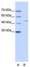 Zinc Finger Protein 555 antibody, TA341496, Origene, Western Blot image 