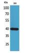 Prostaglandin D2 Receptor 2 antibody, STJ96770, St John