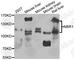 Next to BRCA1 gene 1 protein antibody, A7562, ABclonal Technology, Western Blot image 