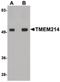 Transmembrane protein 214 antibody, PA5-20792, Invitrogen Antibodies, Western Blot image 