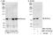 SET Domain And Mariner Transposase Fusion Gene antibody, NBP1-97739, Novus Biologicals, Immunoprecipitation image 