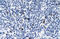 Spliceosome Associated Factor 3, U4/U6 Recycling Protein antibody, orb329773, Biorbyt, Immunohistochemistry paraffin image 