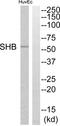 SH2 Domain Containing Adaptor Protein B antibody, abx014877, Abbexa, Western Blot image 