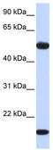 Adenylosuccinate Synthase Like 1 antibody, TA346658, Origene, Western Blot image 