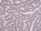 Activating signal cointegrator 1 antibody, GTX119681, GeneTex, Immunohistochemistry paraffin image 