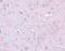 Doublecortin Like Kinase 1 antibody, A03089, Boster Biological Technology, Immunohistochemistry frozen image 