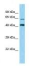 Zinc Finger Protein 667 antibody, NBP1-98333, Novus Biologicals, Western Blot image 
