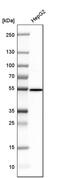 Argininosuccinate Lyase antibody, PA5-53465, Invitrogen Antibodies, Western Blot image 