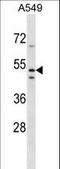 Transmembrane Protein 200A antibody, LS-C203709, Lifespan Biosciences, Western Blot image 