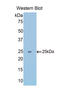 Slit Guidance Ligand 1 antibody, LS-C296457, Lifespan Biosciences, Western Blot image 