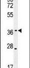 Kelch Domain Containing 1 antibody, PA5-24341, Invitrogen Antibodies, Western Blot image 