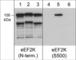 Eukaryotic Elongation Factor 2 Kinase antibody, EP4451, ECM Biosciences, Western Blot image 