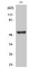 Mitogen-Activated Protein Kinase Kinase Kinase 8 antibody, A01696T290-1, Boster Biological Technology, Western Blot image 