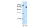 MutS Homolog 2 antibody, 29-555, ProSci, Enzyme Linked Immunosorbent Assay image 