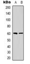 Nuclear Receptor Binding Protein 1 antibody, orb318889, Biorbyt, Western Blot image 