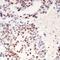 DNA Topoisomerase II Alpha antibody, orb315729, Biorbyt, Immunohistochemistry paraffin image 