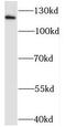 Solute Carrier Family 8 Member A1 antibody, FNab05596, FineTest, Western Blot image 