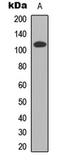 Cell Division Cycle Associated 2 antibody, LS-C354591, Lifespan Biosciences, Western Blot image 
