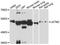Leucine Zipper And EF-Hand Containing Transmembrane Protein 2 antibody, LS-C748889, Lifespan Biosciences, Western Blot image 