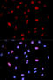 Mitogen-Activated Protein Kinase Kinase 6 antibody, STJ22246, St John