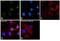 SMAD Family Member 4 antibody, PA5-34806, Invitrogen Antibodies, Immunofluorescence image 
