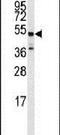 Adrenoceptor Beta 2 antibody, PA5-14118, Invitrogen Antibodies, Western Blot image 