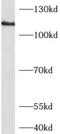 Adenylate Cyclase 1 antibody, FNab00155, FineTest, Western Blot image 