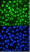 Minichromosome Maintenance Complex Component 2 antibody, A00374-1, Boster Biological Technology, Immunofluorescence image 