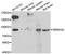 Semaphorin 3A antibody, abx006795, Abbexa, Western Blot image 