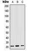 Mitochondrial Ribosomal Protein L18 antibody, LS-C368420, Lifespan Biosciences, Western Blot image 