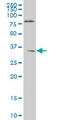 Homeobox protein Nkx-6.1 antibody, LS-C197787, Lifespan Biosciences, Western Blot image 