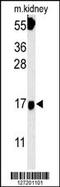 Fibroblast Growth Factor Binding Protein 3 antibody, 61-991, ProSci, Western Blot image 