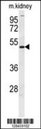 Doublesex And Mab-3 Related Transcription Factor 3 antibody, 55-242, ProSci, Western Blot image 