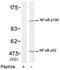 Nuclear Factor Kappa B Subunit 2 antibody, NB100-82063, Novus Biologicals, Western Blot image 