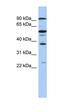Enhancer Of Zeste 1 Polycomb Repressive Complex 2 Subunit antibody, orb329961, Biorbyt, Western Blot image 