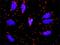 Fibrinogen Alpha Chain antibody, H00002243-M01, Novus Biologicals, Proximity Ligation Assay image 