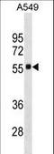 Scavenger Receptor Class B Member 1 antibody, LS-C156030, Lifespan Biosciences, Western Blot image 