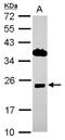Integral Membrane Protein 2C antibody, NBP2-17001, Novus Biologicals, Western Blot image 