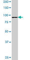 Lysine Acetyltransferase 2B antibody, LS-C139387, Lifespan Biosciences, Western Blot image 