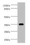 Sulfotransferase Family 1C Member 2 antibody, orb352691, Biorbyt, Western Blot image 